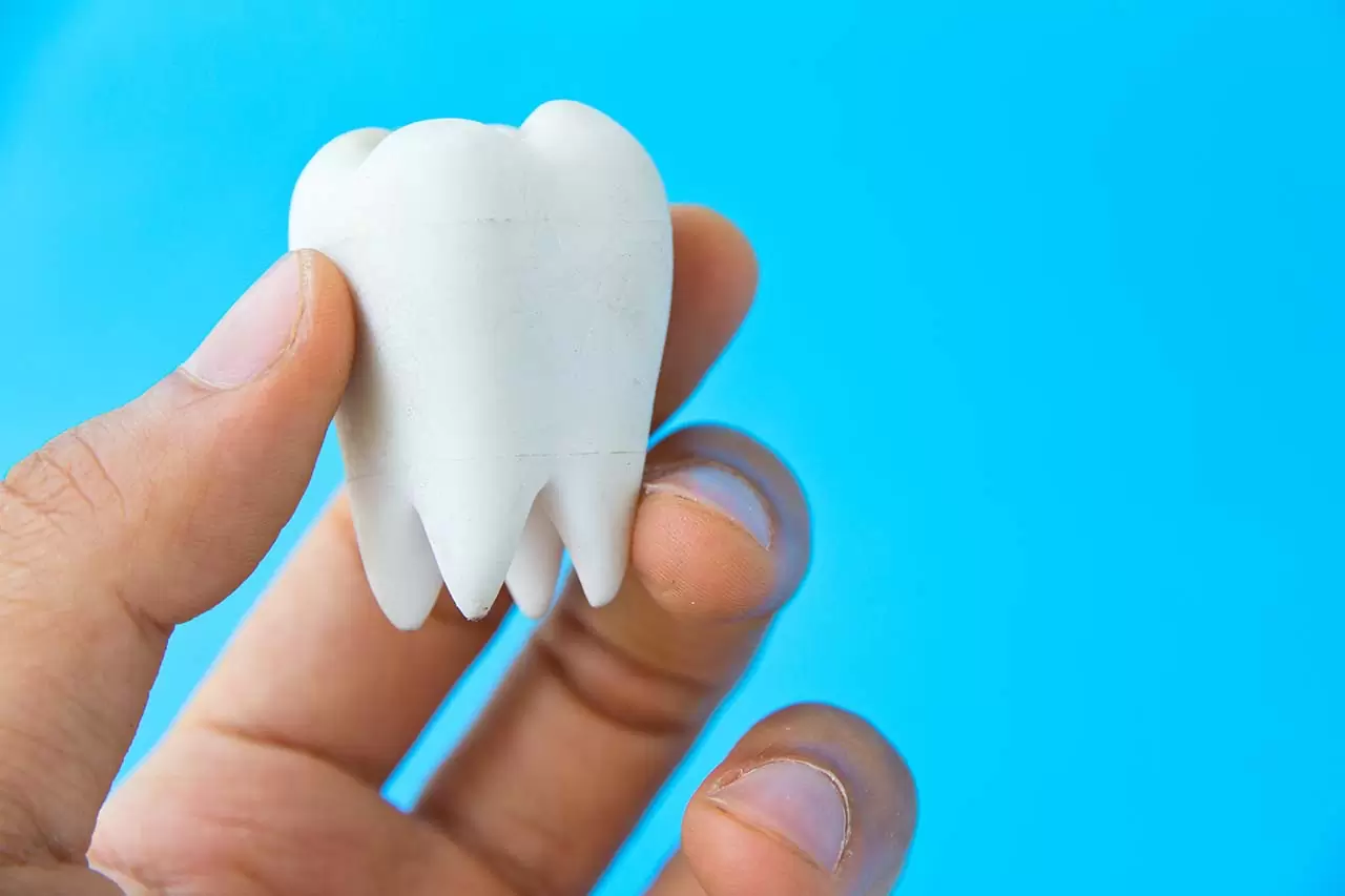 Bagaimana Cara Mencegah Gigi Berlubang?